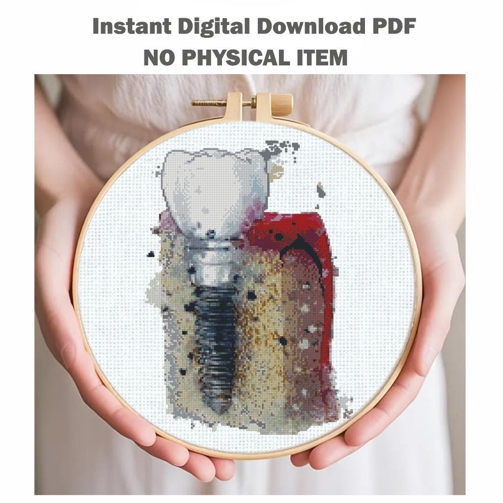 Dental Implant Cross Stitch Pattern PDF, Tooth Anatomy Embroidery Design, Dentist Office Wall Art, Medical Decor Download, Pattern Keeper - NuttyHappyHobby