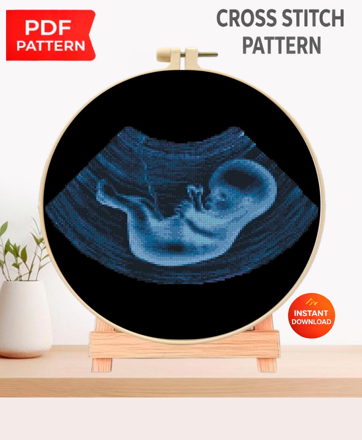 Ultrasound Baby Cross Stitch Pattern PDF, X Ray Fetus Anatomy Embroidery Design, Pregnancy Keepsake Wall Art Download - NuttyHappyHobby