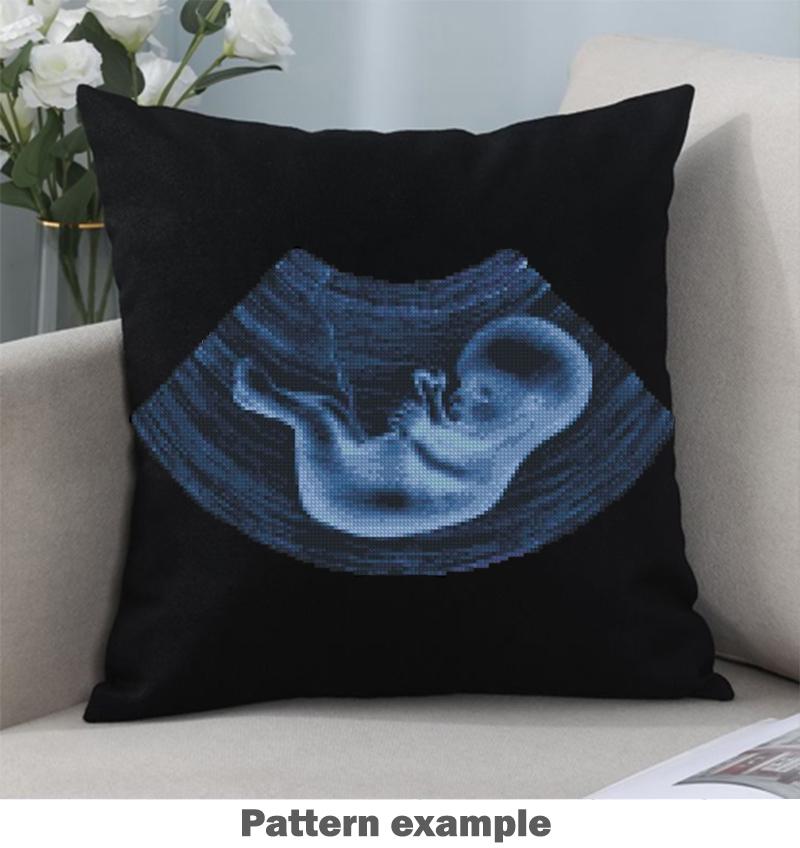 Ultrasound Baby Cross Stitch Pattern PDF, X Ray Fetus Anatomy Embroidery Design, Pregnancy Keepsake Wall Art Download - NuttyHappyHobby